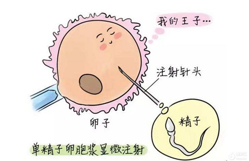 泰国试管婴儿技术好在哪